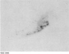 NGC 3995